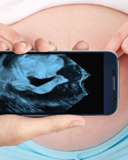 Aplicativos de Ultrassom no Celular para Ver o Bebê