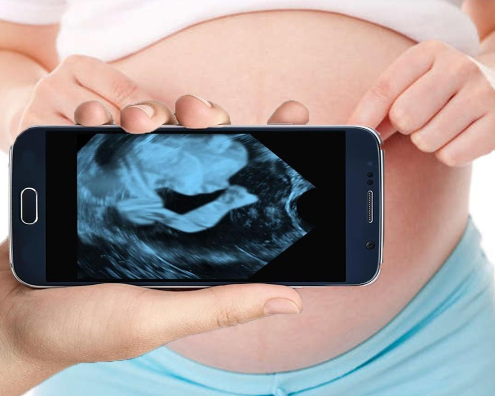 Aplicativos de Ultrassom no Celular para Ver o Bebê